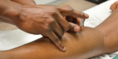 Acupunture addiction detox
